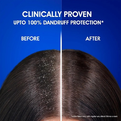 Picture of Indian Product Cool Menthol Anti-dandruff Shmapoo Used For male /female -340 Ml