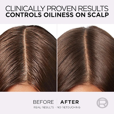 Picture of International Egypt Product Hare Care Loreal Elvive Hayaluron Pure 72hours Purifying Shampoo Used For Male /Female -400 Ml