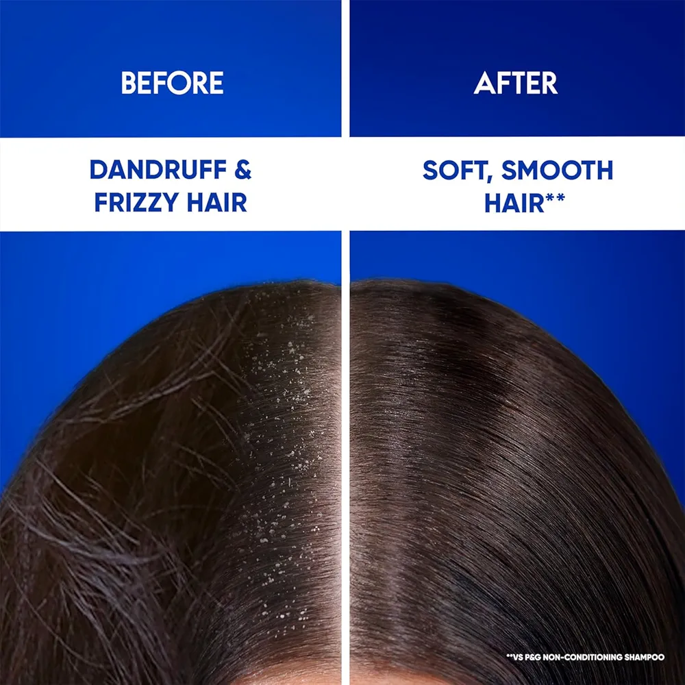 Picture of Indian Product Head & Shoulders Smooth and Silky 2-in-1 Anti Dandruff With Almond Milk Shampoo + Conditioner Used For Male /Female (180ml)