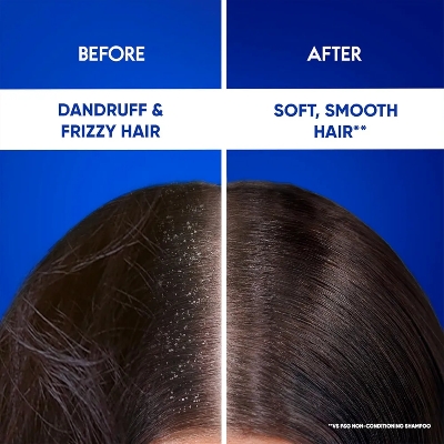 Picture of Indian Product Head & Shoulders Smooth and Silky 2-in-1 Anti Dandruff With Almond Milk Shampoo + Conditioner Used For Male /Female (180ml)