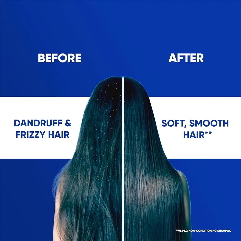 Picture of Indian Product Head & Shoulders Smooth and Silky 2-in-1 Anti Dandruff With Almond Milk Shampoo + Conditioner Used For Male /Female (180ml)
