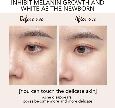 Picture of International Thailand Product  Cream-25gm