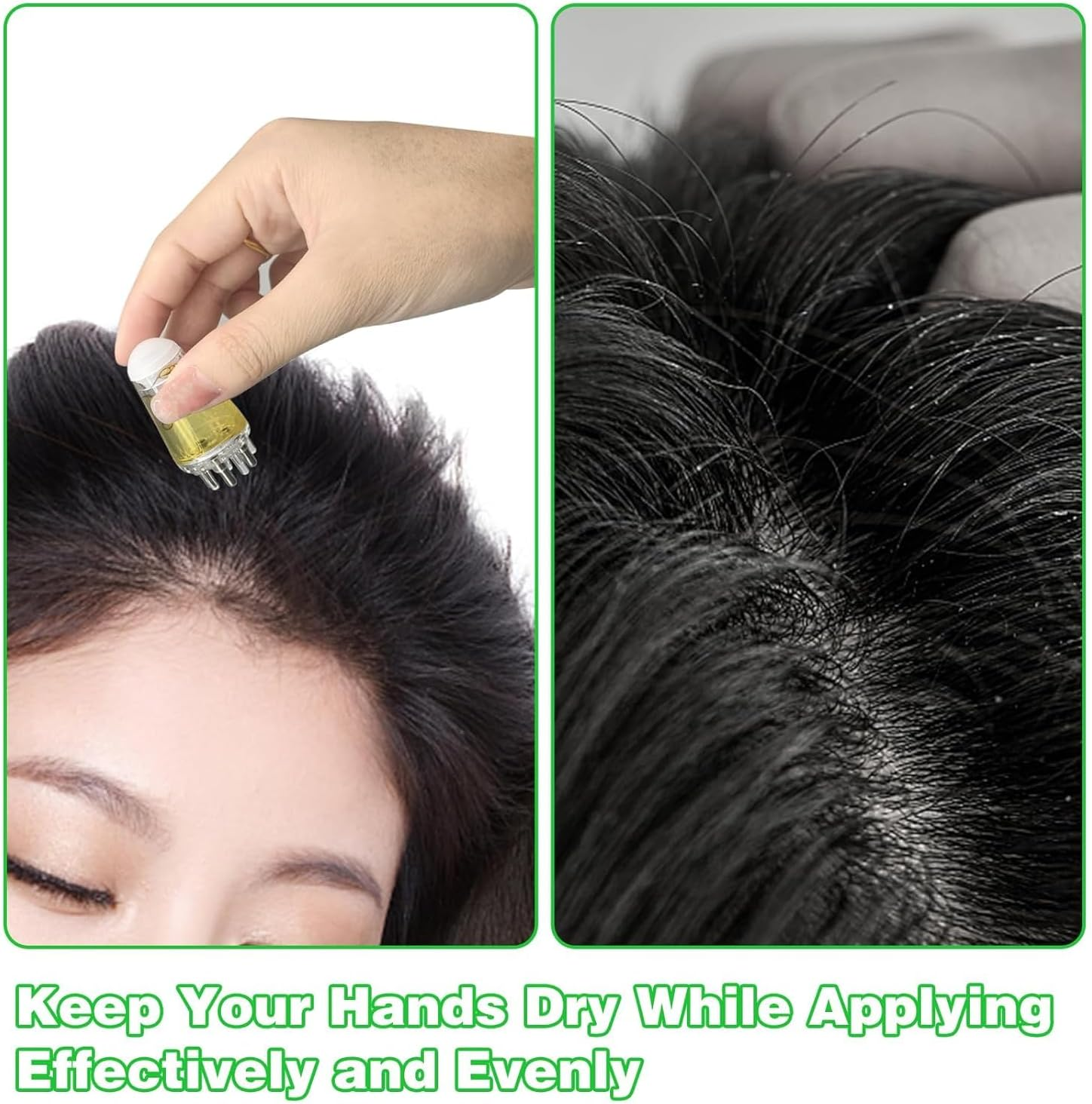 Picture of Medical Grade Minoxidil & Scalp Oil Applicator - Scalp Applicator Comb and Hair Oil Bottle - Ball Root Massager for Hair Growth - Essential Oil Brush for Head Fluid