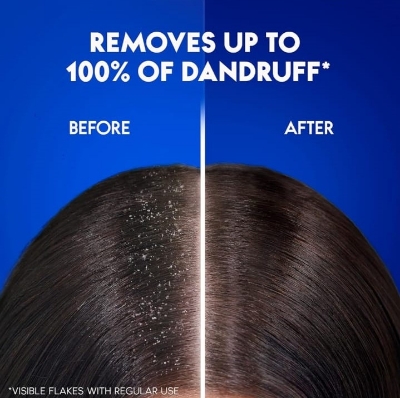 Picture of International UAE product Hair care Head & shoulders CHARCOUL DETOX shampoo used for male/ female - 400 ml