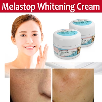Picture of International Korean Product Skin care DERMA HOUSE Melastop Whitening Cream used for male female - 30 ml
