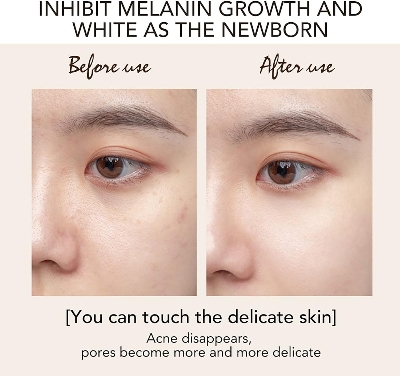 Picture of International Thailand Product Alike Kojic Acid Brightening Cream-25gm