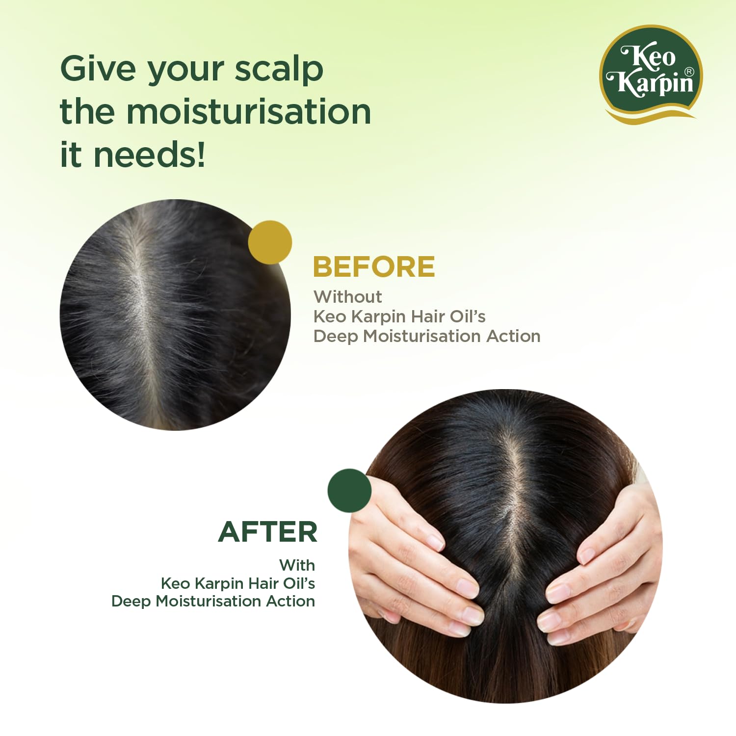 Picture of Keo Karpin Hair Oil |Non-Sticky Hair Oil, Enriched With Natural Vitamin E And Olive Oil 300ml