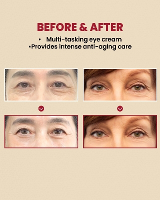 Picture of K-Secret Seoul 1988 Eye Cream : Retinal Liposome 4% + Fermented Bean - 30ml