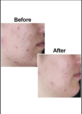 Picture of Kojie San Skin Lightening Even Skin Tone 3 Pcs Soap- 65gX3