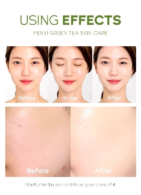 Picture of Fenyi Tea Tree Acne Removal Face Toner Repairing Soothing Tighten Pores - 100ml
