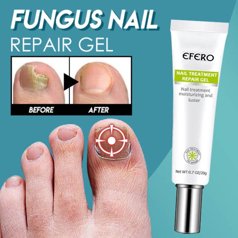 Picture of Efero Nail Repair Treatment Gel Fungus Cream-20gm