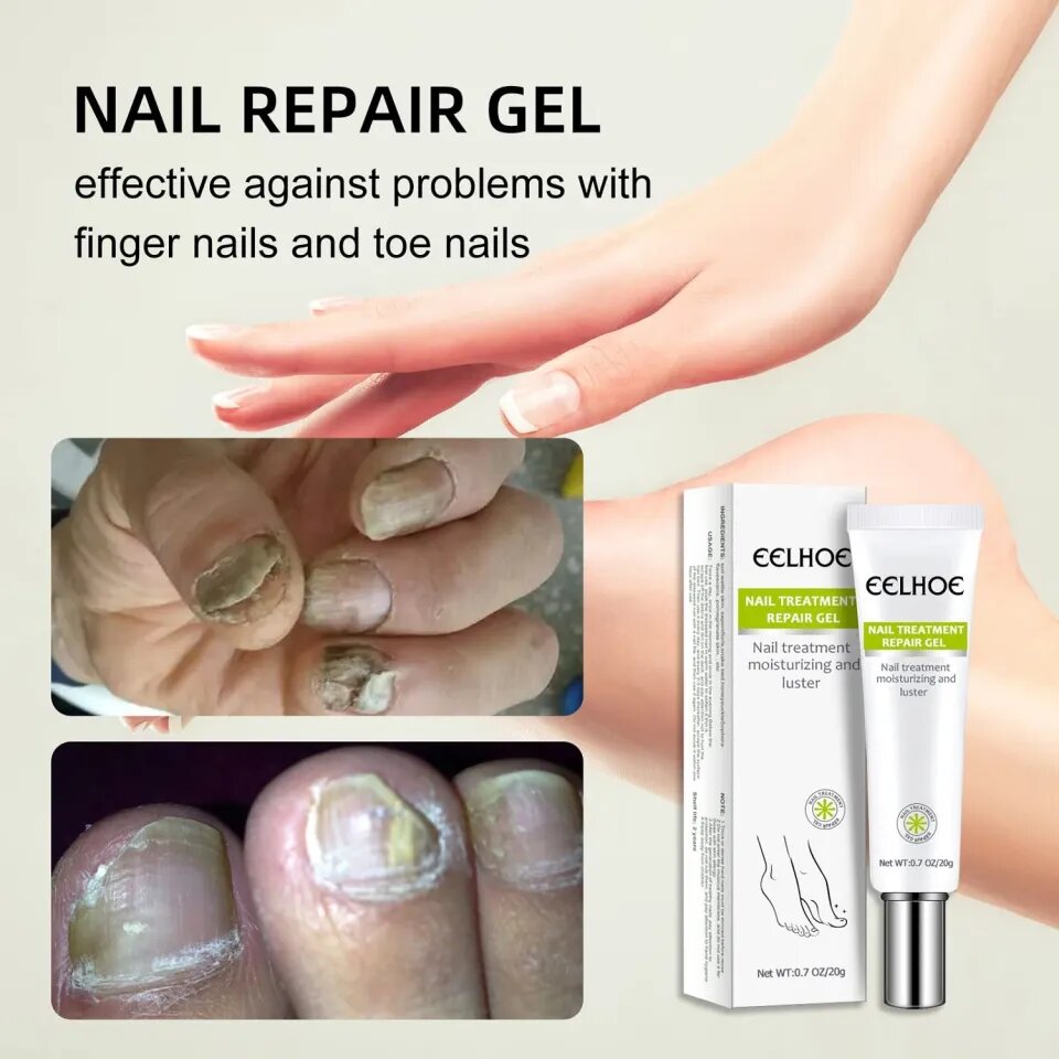 Picture of Efero Nail Repair Treatment Gel Fungus Cream-20gm