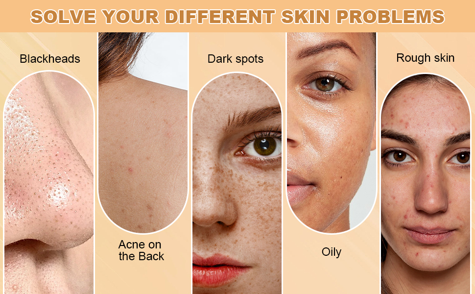 Picture of Kojie San Skin Brightening Soap - Original Kojic Soap that Reduces Dark Spots, Hyperpigmentation, & Scars with Coconut & Tea Tree Oil - 65g x 1 Bar