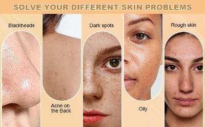 Picture of Kojie San Skin Brightening Soap - Original Kojic Soap that Reduces Dark Spots, Hyperpigmentation, & Scars with Coconut & Tea Tree Oil - 65g x 1 Bar