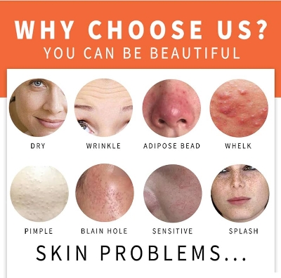 Picture of Kojie San Skin Brightening Soap - Original Kojic Soap that Reduces Dark Spots, Hyperpigmentation, & Scars with Coconut & Tea Tree Oil - 65g x 1 Bar