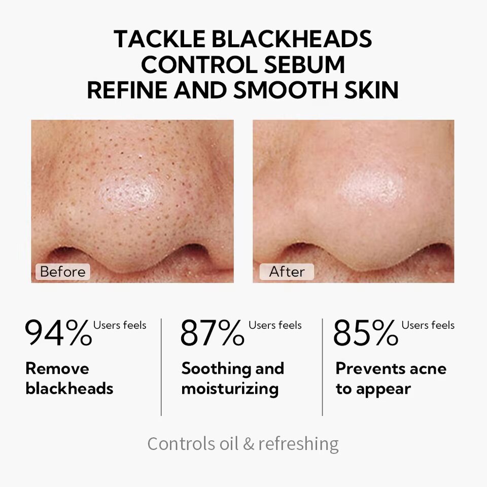 Picture of Lanbena Blackhead Remover Peel-off Mask - 50g face mask