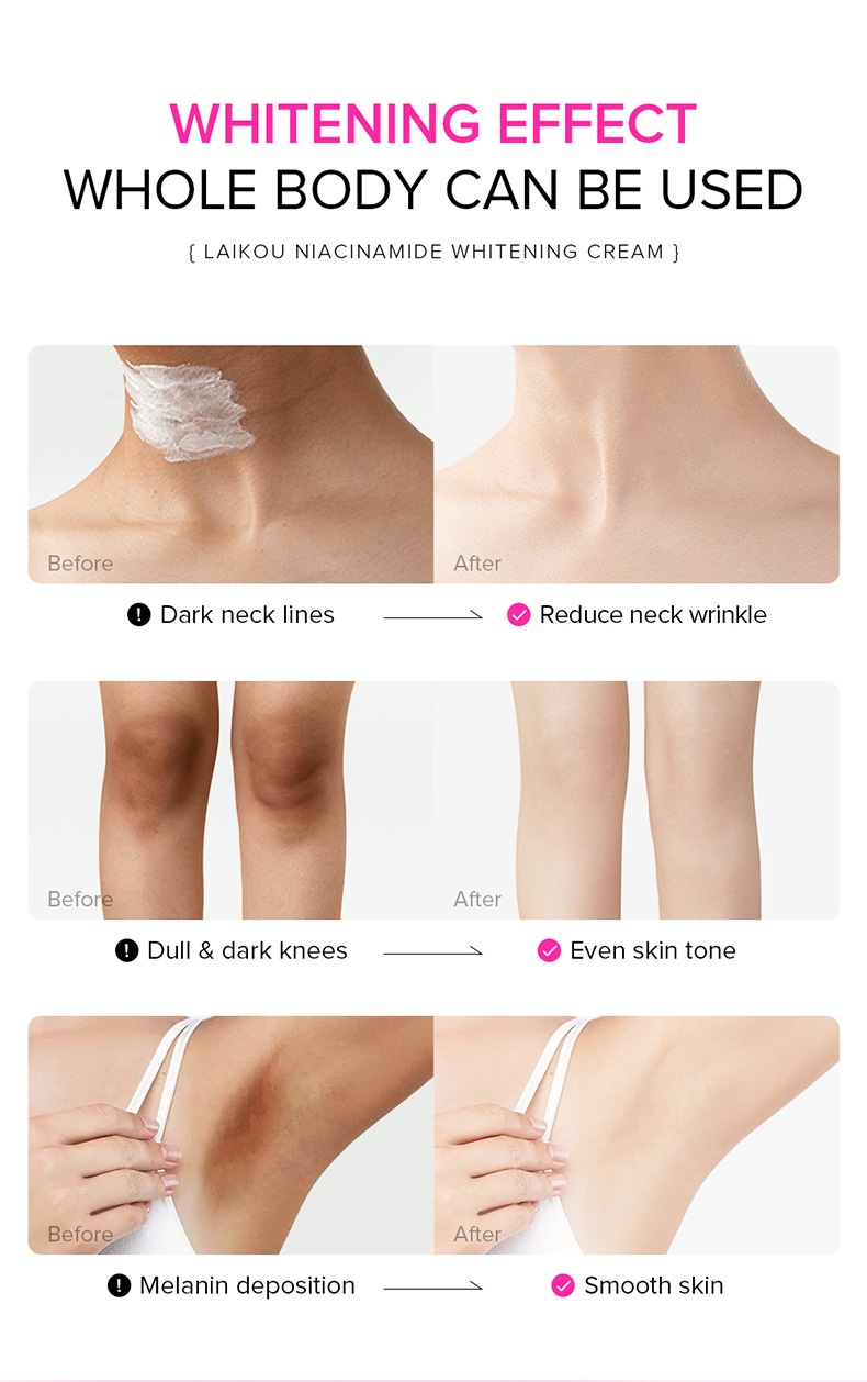Picture of LAIKOU Niacinamide Underarm Knee darkness removing cream 100g
