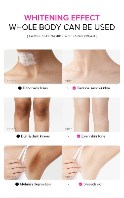Picture of LAIKOU Niacinamide Underarm Knee darkness removing cream 100g