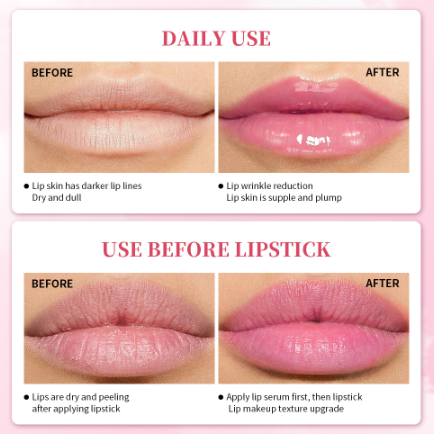 Picture of Lanbena Lip Lightening Serum Lip Plumper