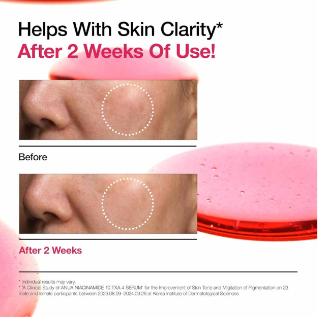Picture of Anua Niacinamide 10% + TXA 4% Serum 30ml (Korea)
