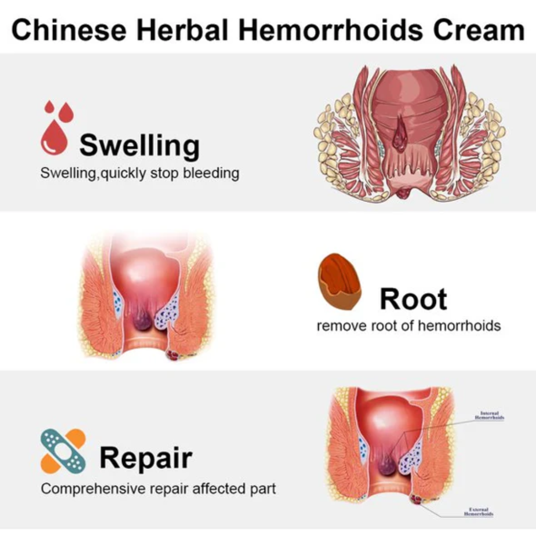 Picture of Dictamni Herbal Cream for Hemorrhoids 20 G Hemorrhoids Cream Hemorrhoids Relief Cream Hemorrhoids Healing Cream