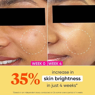 Picture of Dot & Key Vitamin C + E  Super Bright Moisturizer For Glowing Skin - 60ml