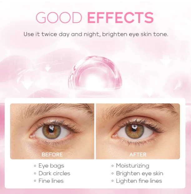 Picture of Fenyi Japan Cherry Blossom Eye Cream - 15g