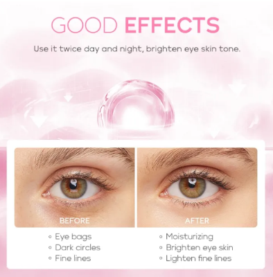 Picture of Fenyi Japan Cherry Blossom Eye Cream - 15g