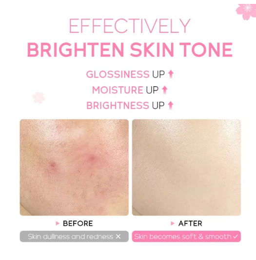 Picture of Fenyi Japan Cherry Blossom Serum - 17ml