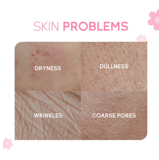 Picture of Fenyi Japan Cherry Blossom Serum - 17ml