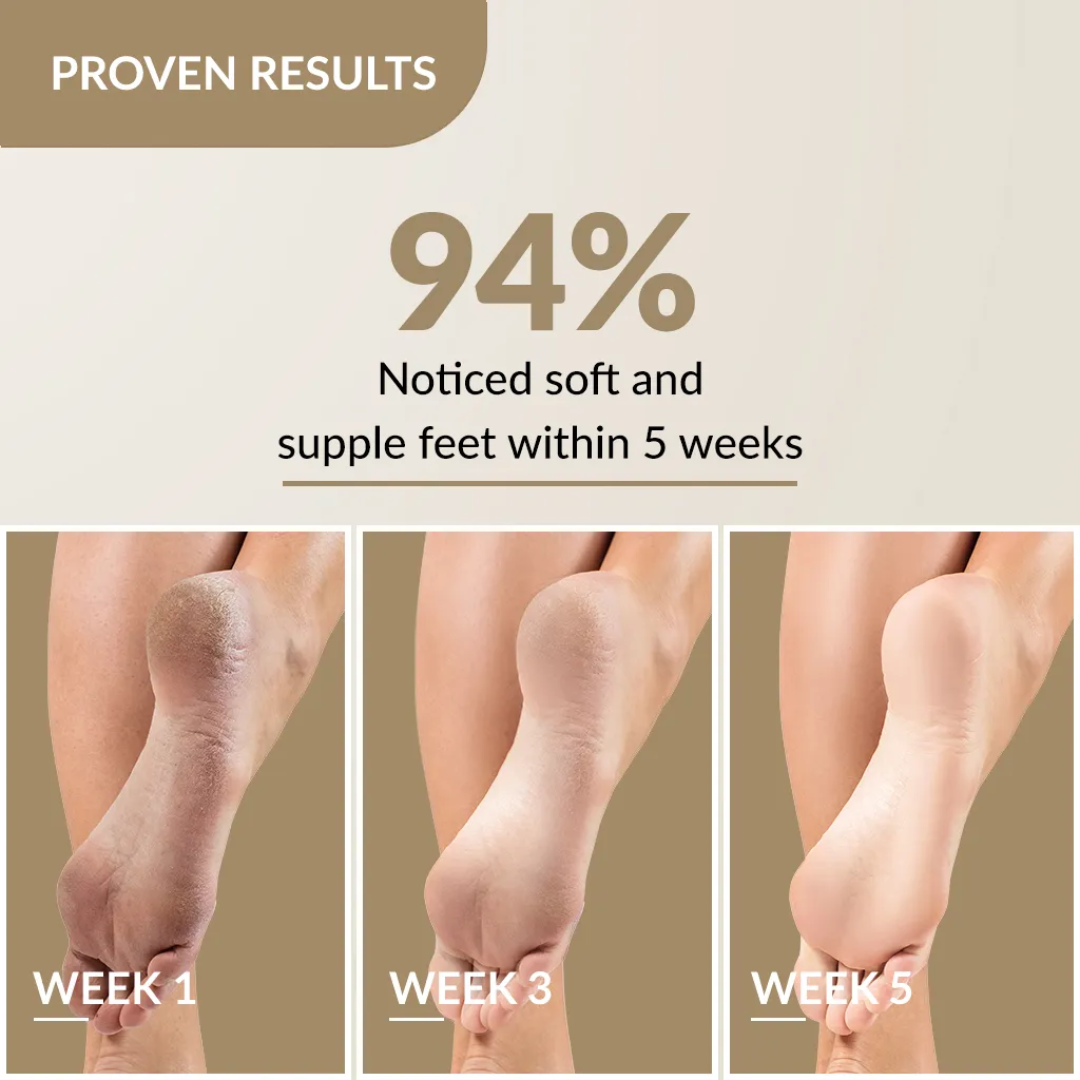 Picture of Fixderma Foobetik Foot Cream - Dry & Cracked Heels Cream - 50g