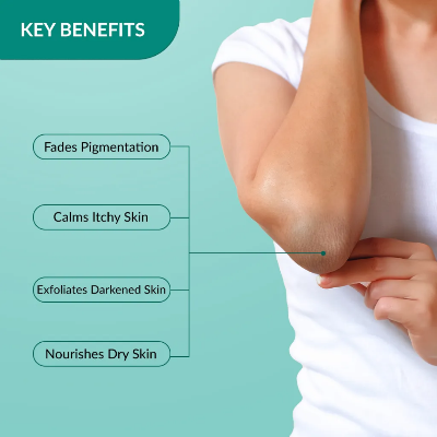 Picture of Fixderma Nigrifix Cream for Acanthosis Nigricans with Lactic Acid - 50g