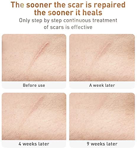 Picture of Lanbena TCM Scar Removing Gel - 30g