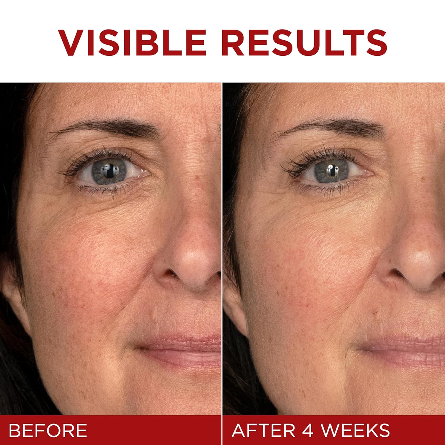 Picture of L'Oreal Paris Revitalift Triple Power Anti-Aging Face Moisturizer, Pro Retinol, Hyaluronic Acid & Vitamin C to Reduce Wrinkles, Firm & Brighten Skin, 1.7 Oz