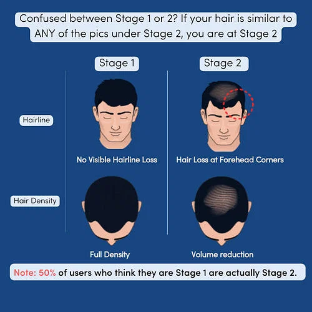 Picture of Man Matters Anti Hair Fall Shampoo - 200ml