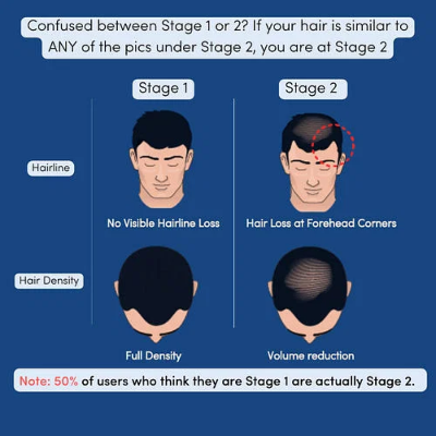 Picture of Man Matters Anti Hair Fall Shampoo - 200ml