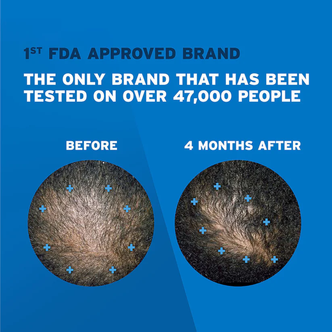 Picture of Men's Rogaine 5% Minoxidil Foam for Hair Regrowth - 1 Month Supply