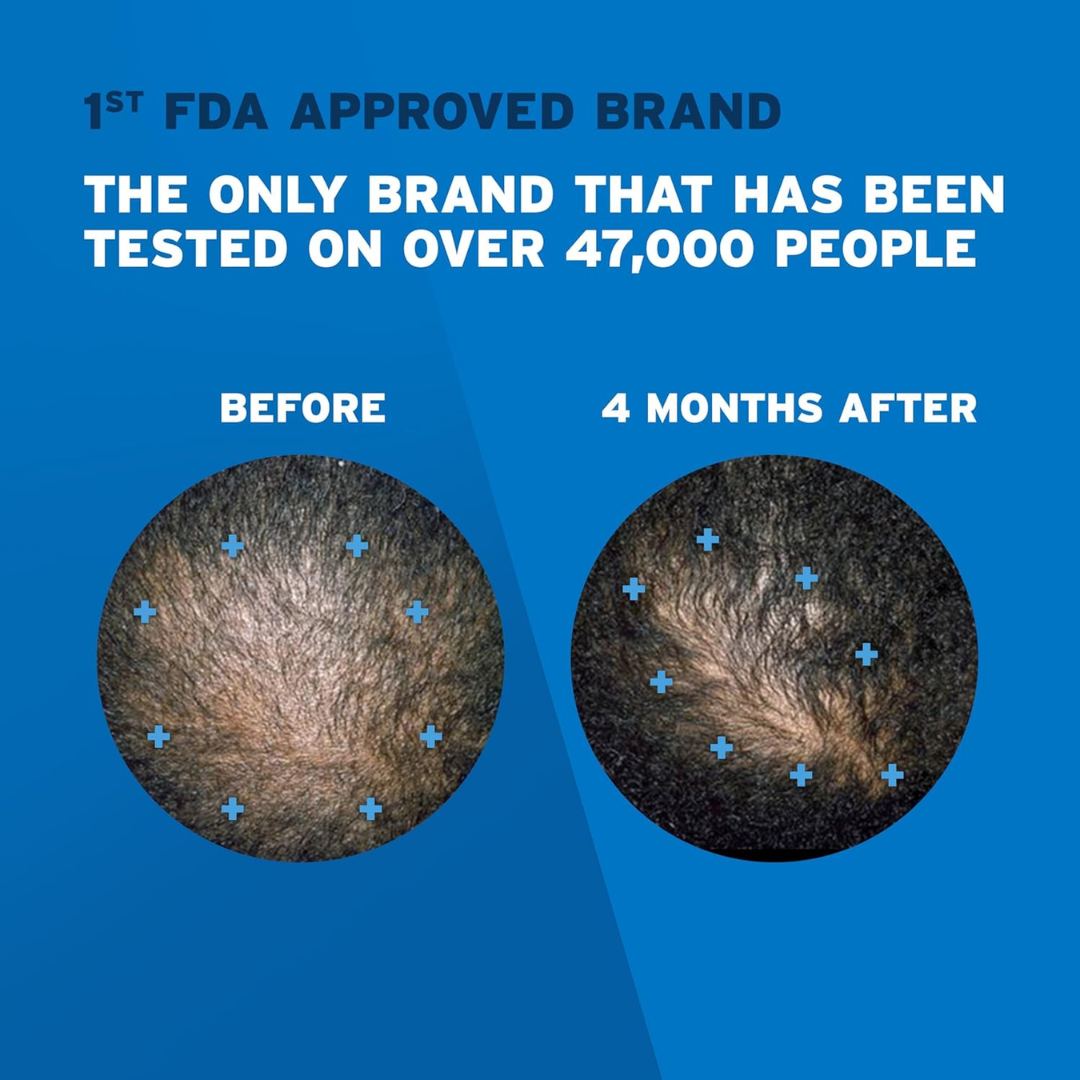 Picture of Men's Rogaine 5% Minoxidil Foam Hair Regrowth Treatment - 3 Month Supply