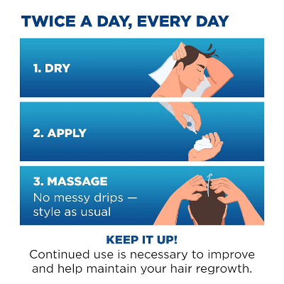 Picture of Men's Rogaine 5% Minoxidil Foam Hair Regrowth Treatment - 3 Month Supply