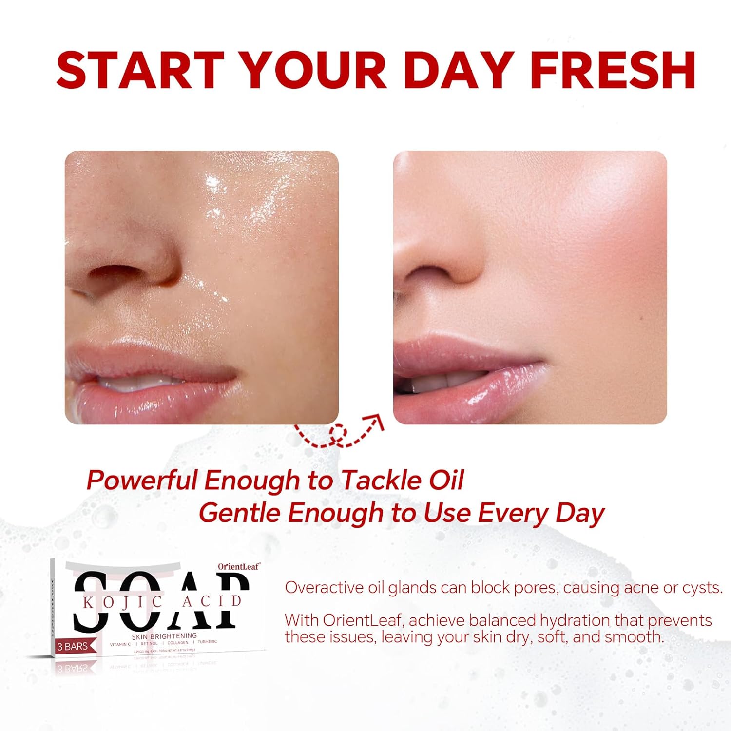 Picture of ORIENTLEAF Kojic Acid Soap, Turmeric Soap Bar for Dark Spots, Fresh Citurs Scent, Gentle for Face and Body Wash with Vitamin C, Shea Butter, Retinol, Olive Oil, Collagen (3 PACK)