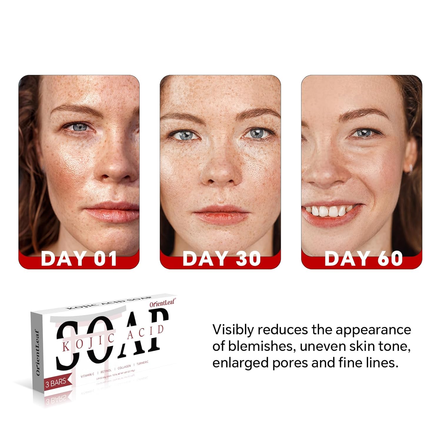 Picture of ORIENTLEAF Kojic Acid Soap, Turmeric Soap Bar for Dark Spots, Fresh Citurs Scent, Gentle for Face and Body Wash with Vitamin C, Shea Butter, Retinol, Olive Oil, Collagen (3 PACK)