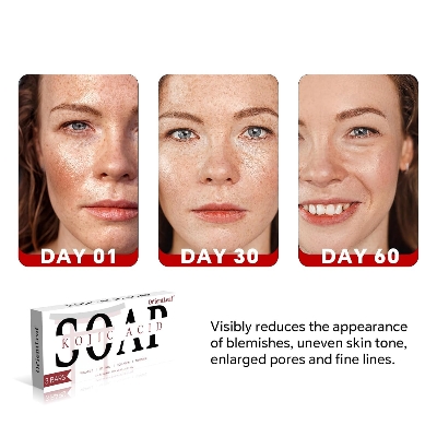 Picture of ORIENTLEAF Kojic Acid Soap, Turmeric Soap Bar for Dark Spots, Fresh Citurs Scent, Gentle for Face and Body Wash with Vitamin C, Shea Butter, Retinol, Olive Oil, Collagen (3 PACK)