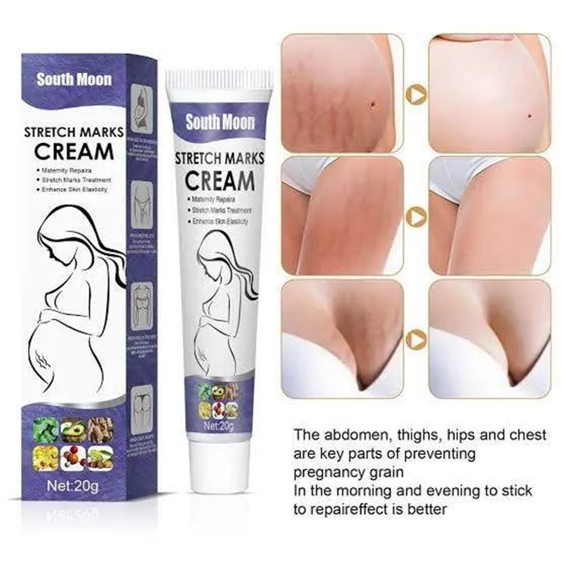 Picture of South Moon Effective Body Stretch Marks Removal Cream Lotion Pregnancy Stretch Mark Cream for Fair Skin Repair Cream 20g