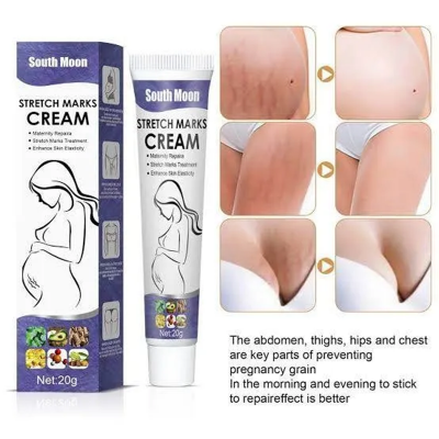 Picture of South Moon Effective Body Stretch Marks Removal Cream Lotion Pregnancy Stretch Mark Cream for Fair Skin Repair Cream 20g