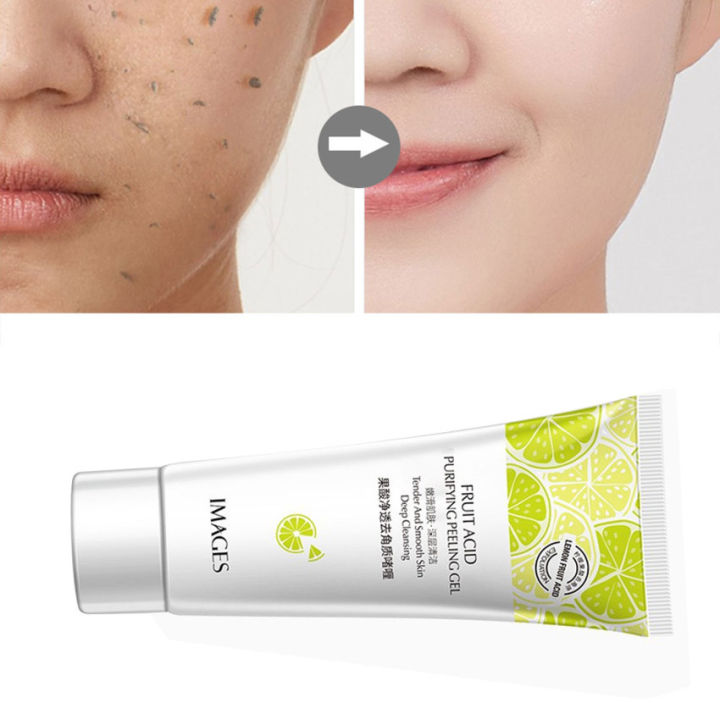 Picture of IMAGES FRUIT ACID PURIFYING PEELING GEL TENDER AND SMOOTH SKIN DEEP CLEANSING(1pcs)