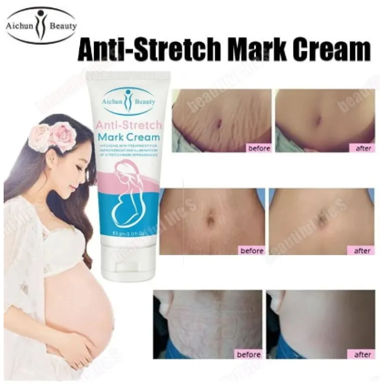 Picture of Aichun Beauty Anti-Stretch Marks Cream | Stretch Marks Removal Cream 60g