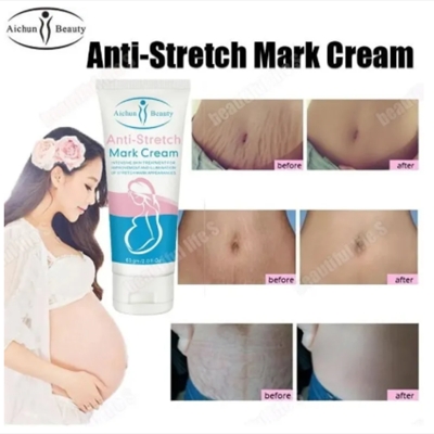 Picture of Aichun Beauty Anti-Stretch Marks Cream | Stretch Marks Removal Cream 60g