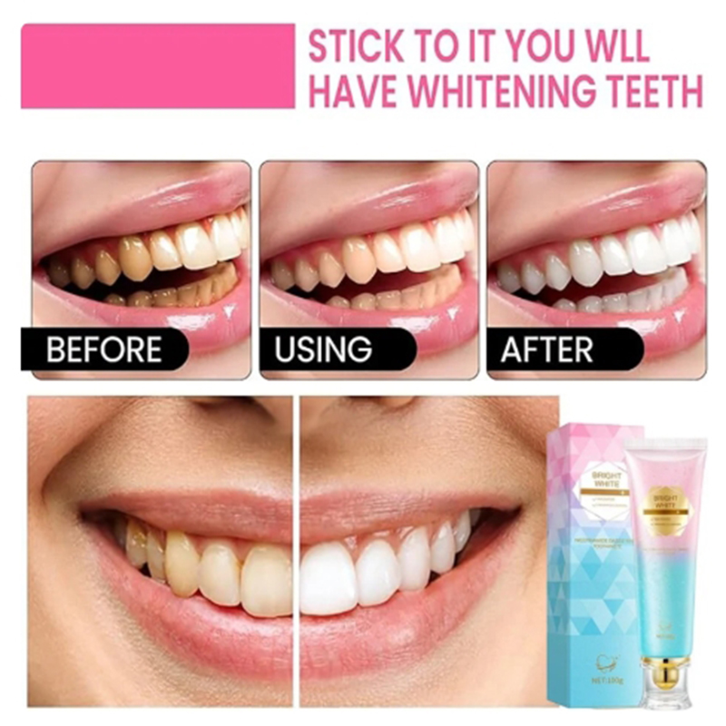 Picture of Niacinamide Whitening Toothpaste-100gm