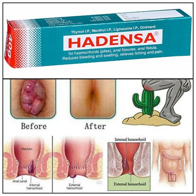 Picture of Indian Hadensa Ointment For Piles - 20gm