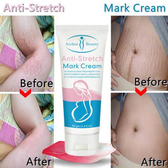 Picture of Aichun Beauty Anti Stretch Mark Cream 60gm